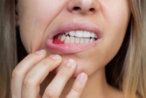 Bleeding Gums and Liver Disease pain